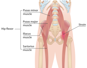 Psoas spier